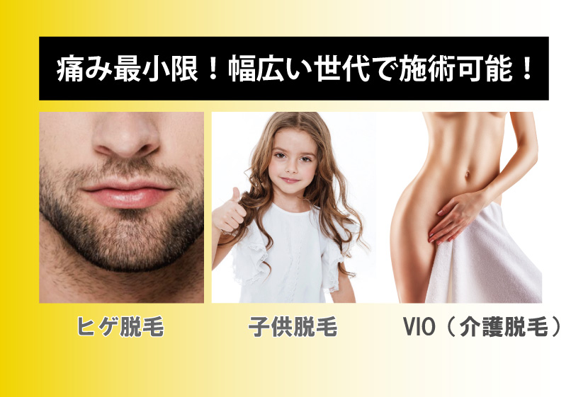 ペガサスプロX 痛み最小限