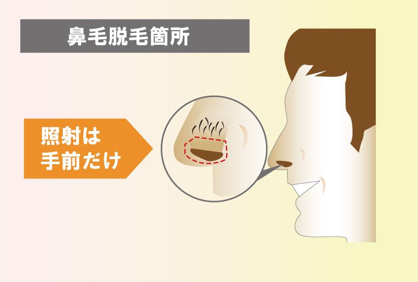 鼻毛脱毛可能箇所