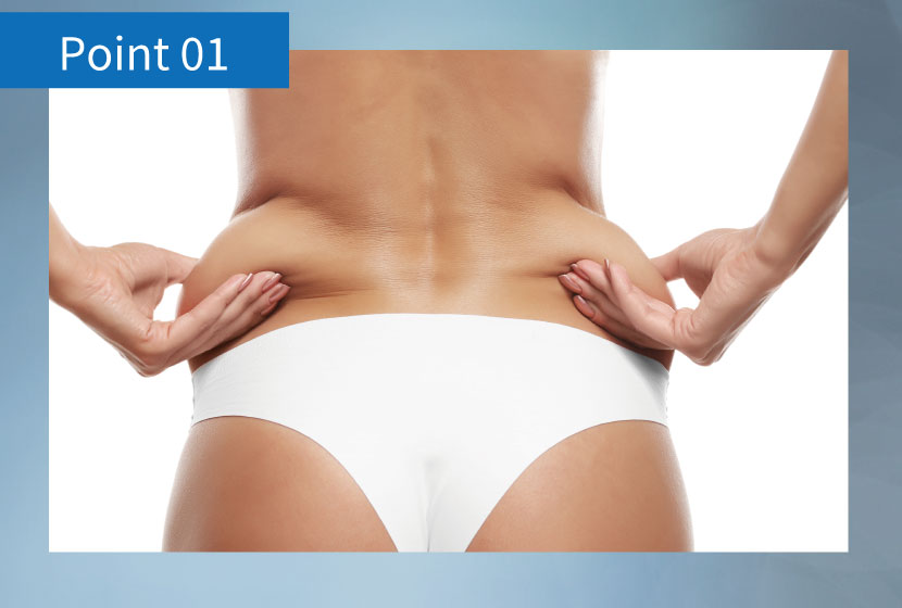 脂肪冷却で部分痩せしたい